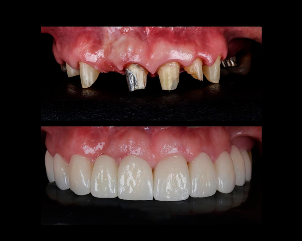 Rehabilitaciòn Oral