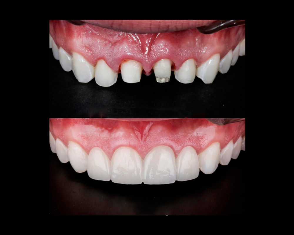 Rehabilitaciòn Oral