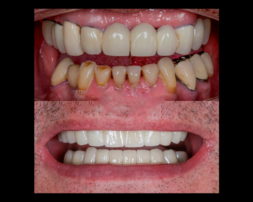 Rehabilitación Oral