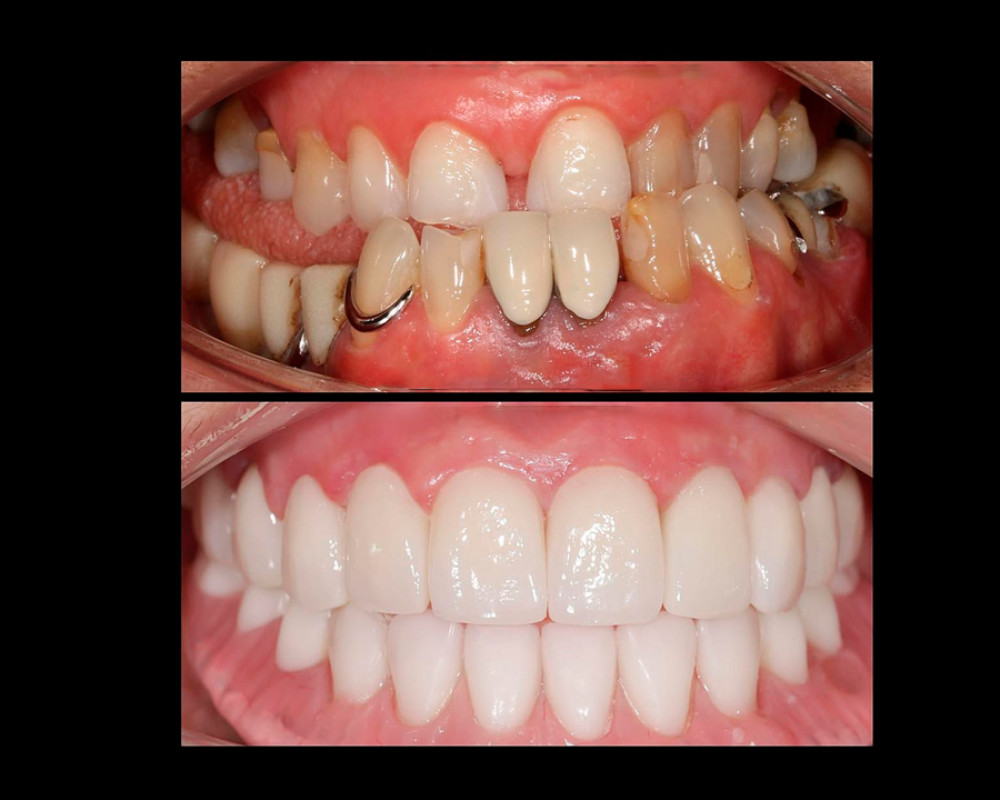 Rehabilitacion Oral 5