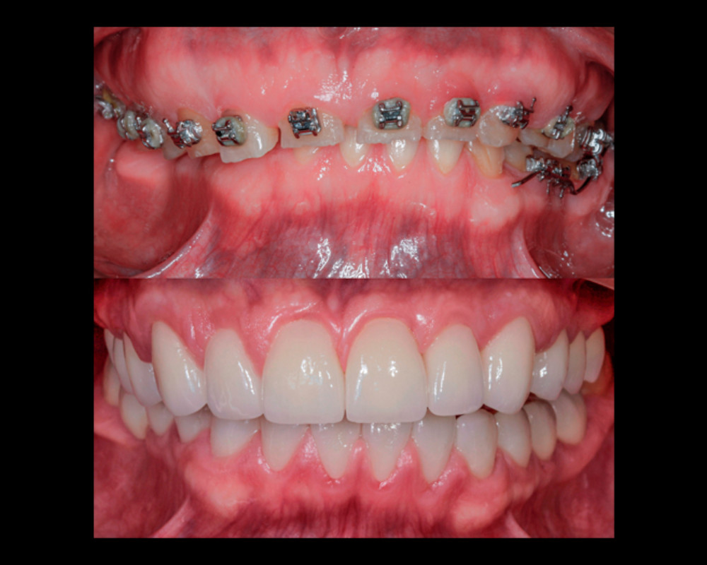 Rehabilitación Oral