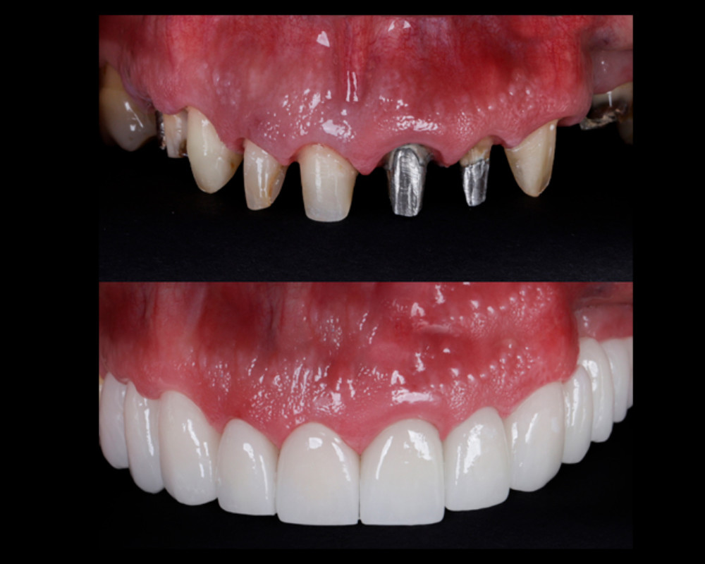 Rehabilitación Oral